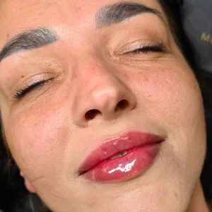 MODELOWANIE UST - Modelowanie ust 1ml - zdjęcie 5