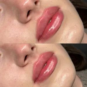 MODELOWANIE UST - Modelowanie ust 1ml - zdjęcie 14