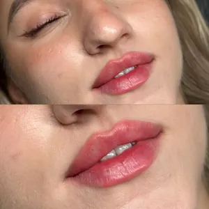 MODELOWANIE UST - Modelowanie ust 1ml - zdjęcie 12