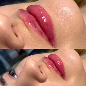 MODELOWANIE UST - Modelowanie ust 1ml - zdjęcie 9